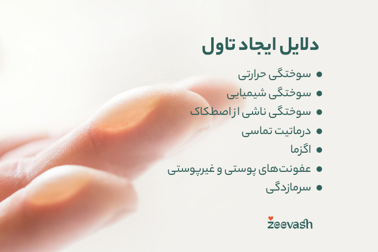 دلایل ایجاد تاول
